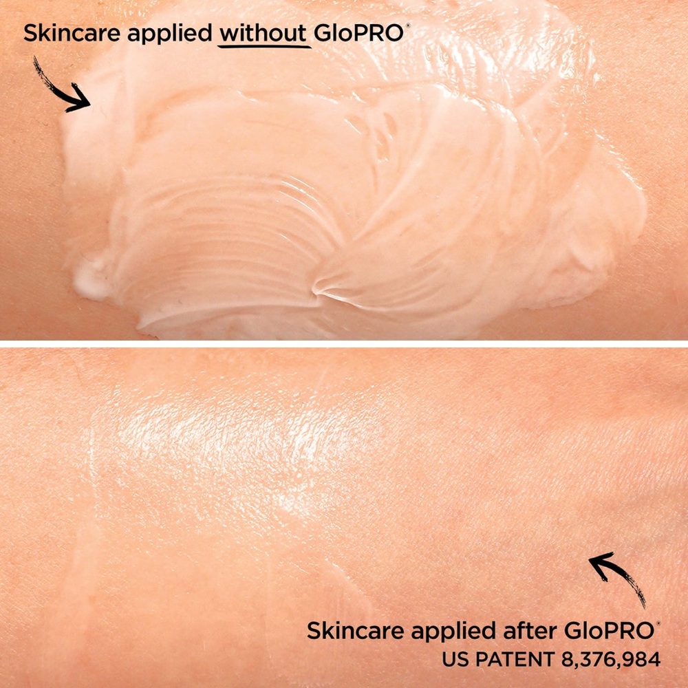 New In Box Beauty Bio GloPRO Microneedling Facial Regeneration Tool - Picture 4 of 4